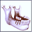 back teeth